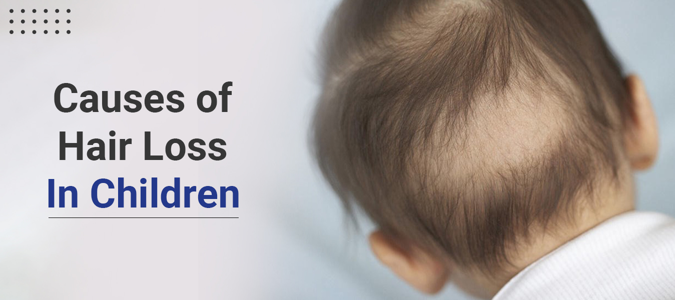 Causes of Hair Loss In Children